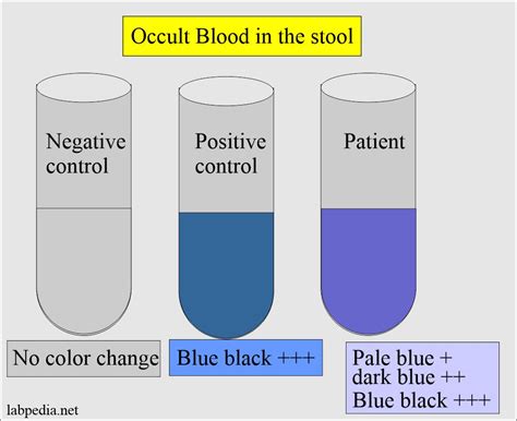 Diagnosing and Managing Positive Fecal Occult Blood: A Multidisciplinary Approach